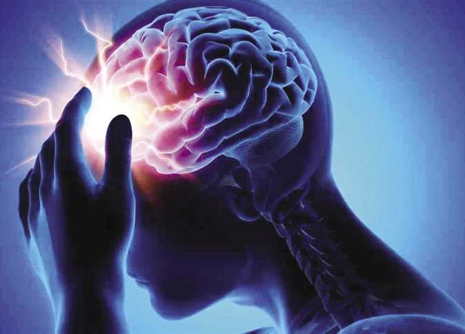 السكتة الدماغية