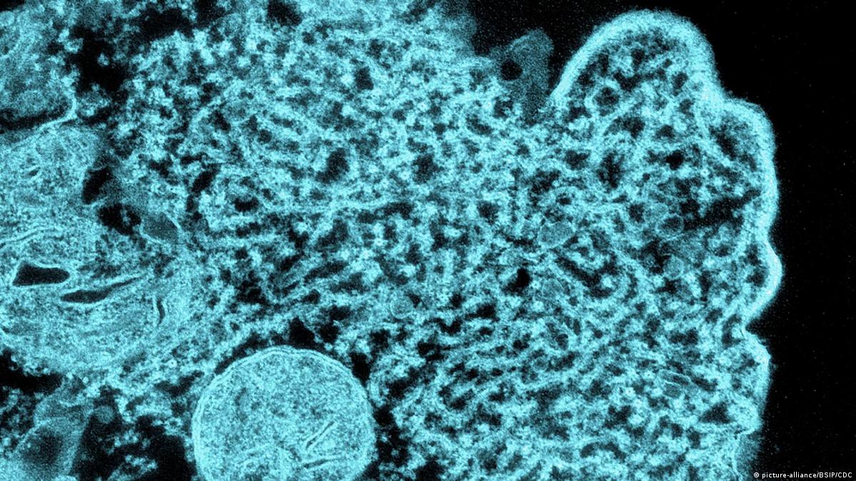 فيروس نيباه Nipah virus